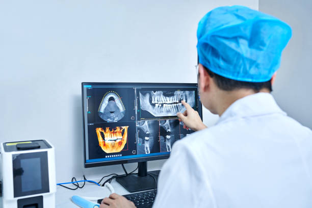 Best Emergency Tooth Extraction in Ly Lake, IL